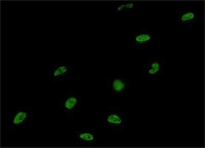 Immunocytochemistry/ Immunofluorescence: U1A Antibody (3F9-1F7) [H00006626-M01]