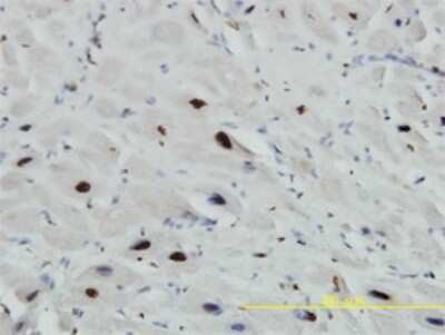 Immunohistochemistry-Paraffin: U1A Antibody (3F9-1F7) [H00006626-M01]