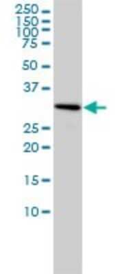 Western Blot: U1A Antibody (3F9-1F7) [H00006626-M01]