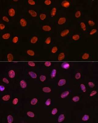Immunocytochemistry/ Immunofluorescence: U1A Antibody (8I3P5) [NBP3-16247]
