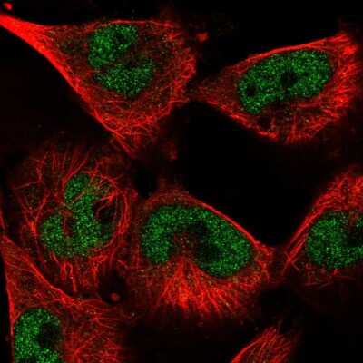 Immunocytochemistry/ Immunofluorescence: U1A Antibody [NBP2-58268]