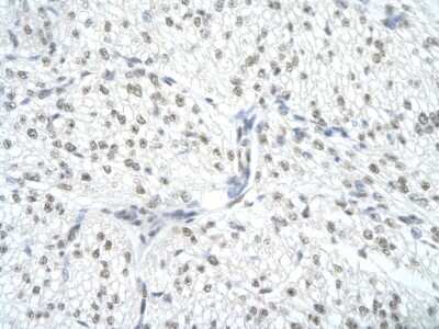 Immunohistochemistry: U1A Antibody [NBP1-80452]