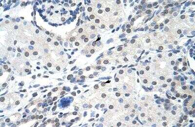 Immunohistochemistry-Paraffin: U1A Antibody [NBP1-80452]