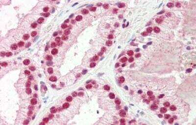 Immunohistochemistry-Paraffin: U1A Antibody [NBP1-80452]