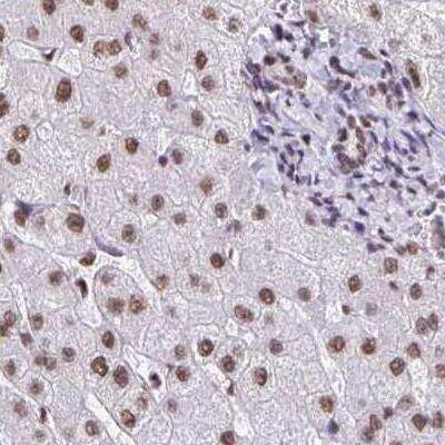 Immunohistochemistry-Paraffin: U1A Antibody [NBP2-33465]
