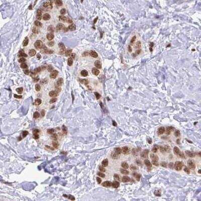Immunohistochemistry-Paraffin: U1A Antibody [NBP2-33465]