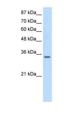 Western Blot: U1A Antibody [NBP1-80452]