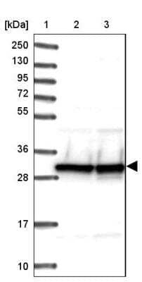 Western Blot: U1A Antibody [NBP2-33465]