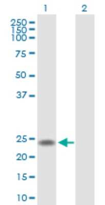 Western Blot: U2AF1L4 Antibody [H00199746-B01P]