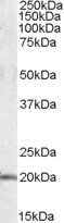 Western Blot: U2AF1L4 Antibody [NBP1-06996]