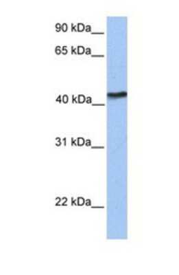 Western Blot: IGFLR1/TMEM149 Antibody [NBP1-69417]