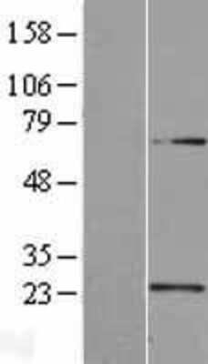 Western Blot: U2AF1L4 Overexpression Lysate [NBL1-17492]