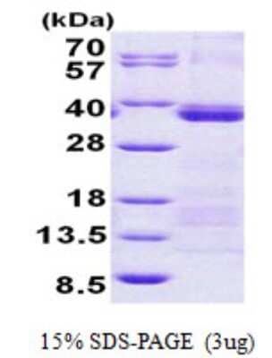 SDS-PAGE: Recombinant Human U2AF35 His Protein [NBP2-22915]