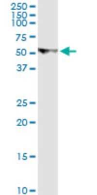 Western Blot: U2AF2 Antibody (5G8) [H00011338-M03]