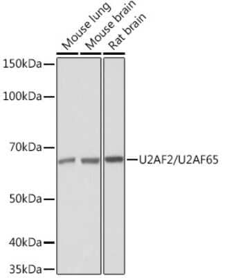 Western Blot: U2AF2 Antibody (8E8R9) [NBP3-16432]