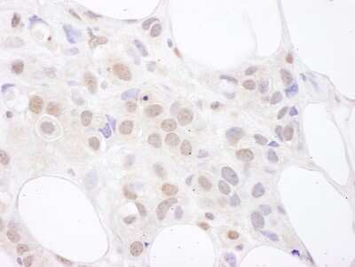 Immunohistochemistry: U2AF2 Antibody [NBP2-04139]