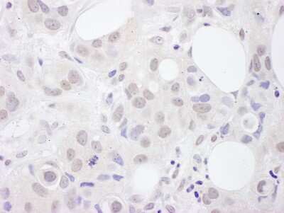 Immunohistochemistry-Paraffin: U2AF2 Antibody [NBP2-04140]