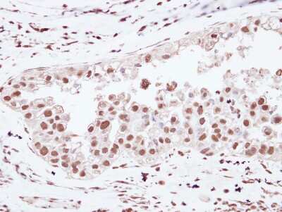 Immunohistochemistry-Paraffin: U2AF2 Antibody [NBP2-20775]