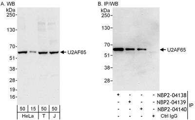 Immunoprecipitation: U2AF2 Antibody [NBP2-04139]