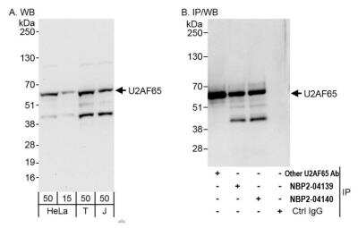 Immunoprecipitation: U2AF2 Antibody [NBP2-04139]