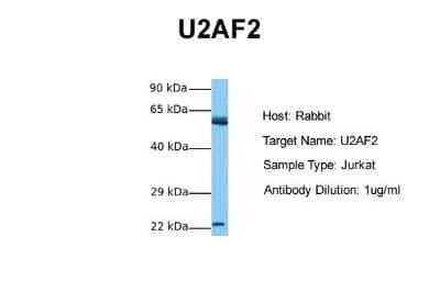 Western Blot: U2AF2 Antibody [NBP1-57251]