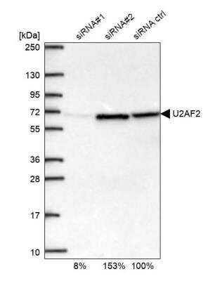 Western Blot: U2AF2 Antibody [NBP2-33397]