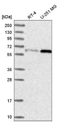 Western Blot: U2AF2 Antibody [NBP2-58989]