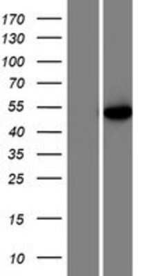 Western Blot: U2AF2 Overexpression Lysate [NBP2-07511]