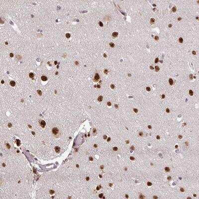 Immunohistochemistry: U2AF35 Antibody [NBP2-46797]