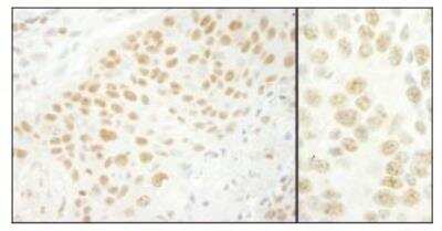 Immunohistochemistry-Paraffin: U2AF35 Antibody [NBP1-19120]