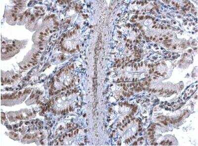 Immunohistochemistry-Paraffin: U2AF35 Antibody [NBP1-32515]