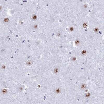 Immunohistochemistry-Paraffin: U2AF35 Antibody [NBP1-92553]