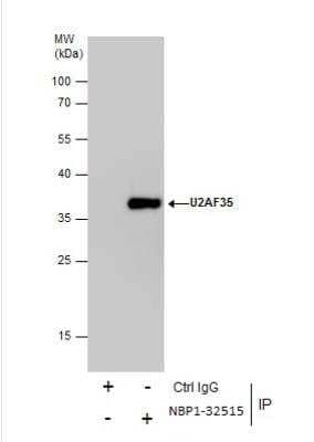 Immunoprecipitation: U2AF35 Antibody [NBP1-32515]