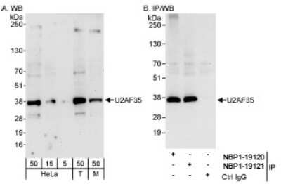 Western Blot: U2AF35 Antibody [NBP1-19120]