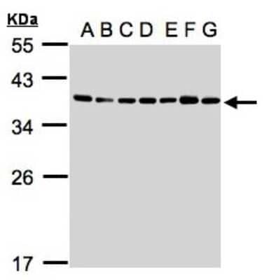 Western Blot: U2AF35 Antibody [NBP1-32515]