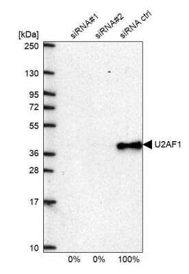 Western Blot: U2AF35 Antibody [NBP1-92553]