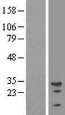 Western Blot: U2AF35 Overexpression Lysate [NBL1-17490]