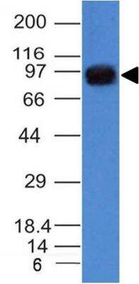 Western Blot: UACA Antibody (AE-5)Azide and BSA Free [NBP3-11314]