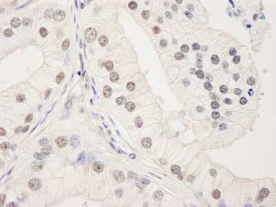 Immunohistochemistry: UACA Antibody [NB100-61622]