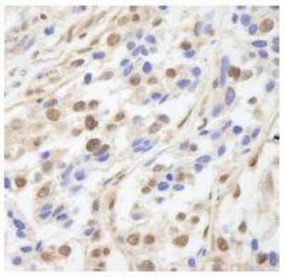 Immunohistochemistry-Paraffin: UACA Antibody [NB100-61622]