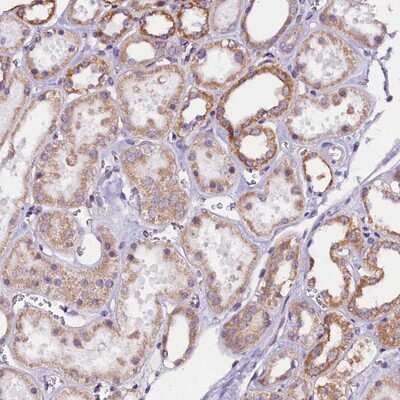 Immunohistochemistry-Paraffin: UACA Antibody [NBP1-92554]