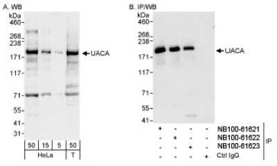 Western Blot: UACA Antibody [NB100-61623]