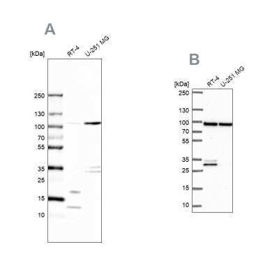 Western Blot: UAF1/WDR48 Antibody [NBP1-81404]