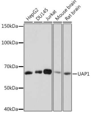 Western Blot: UAP1 Antibody (5S7M2) [NBP3-16671]