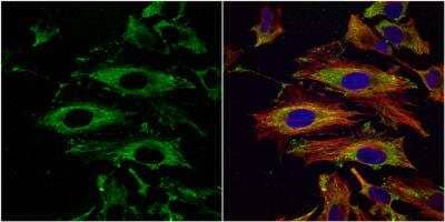 Immunocytochemistry/ Immunofluorescence: UAP1 Antibody [NBP1-32823]