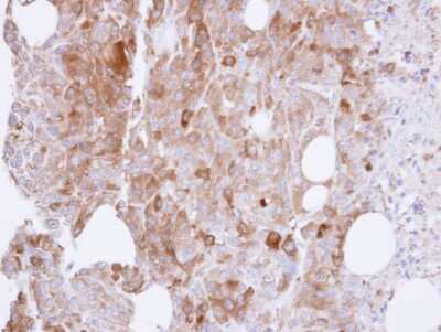 Immunohistochemistry-Paraffin: UAP1 Antibody [NBP1-32823]