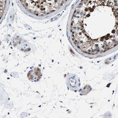 Immunohistochemistry-Paraffin: UAP1 Antibody [NBP1-89197]