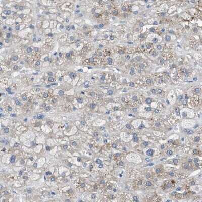 Immunohistochemistry-Paraffin: UAP1 Antibody [NBP1-89197]