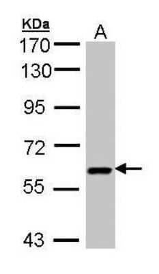 Western Blot: UAP1 Antibody [NBP1-32823]