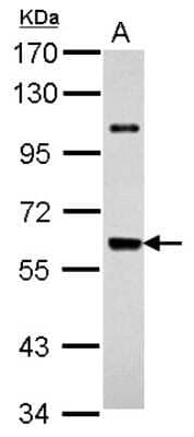 Western Blot: UAP1 Antibody [NBP2-20776]